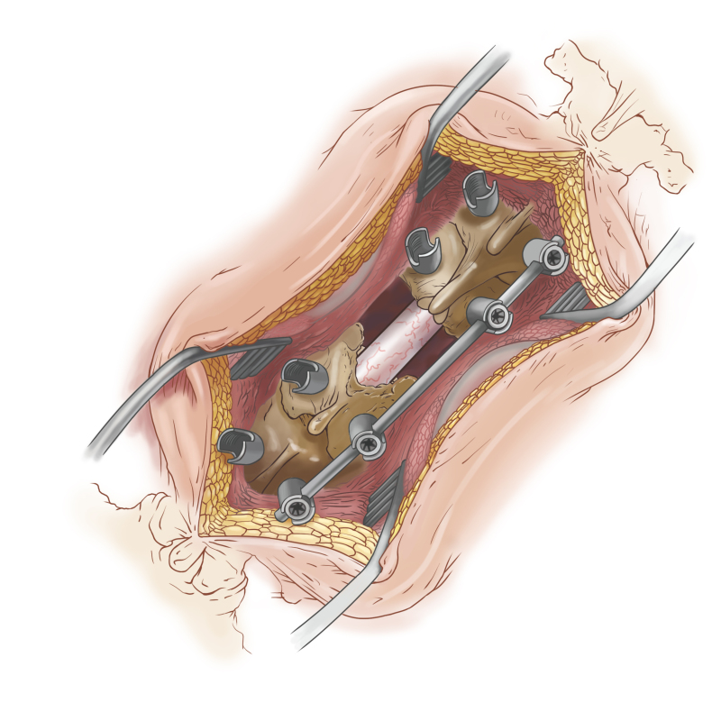 骨科手术解析图